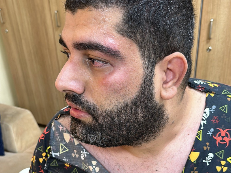 Diyarbakır’da Sağlık Çalışanlarına Yönelik Şiddet!-1