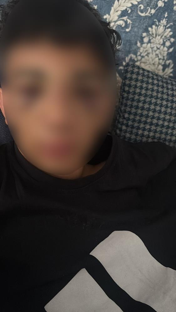 Ağrı’da 14 Yaşındaki Çocuğa Grup Saldırısı (2)