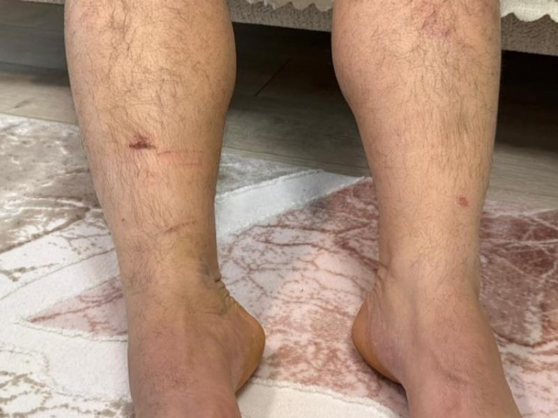 Diyarbakır’da Kuzen Dehşeti Şantiyeye Kaçırıp Işkence Yaptılar