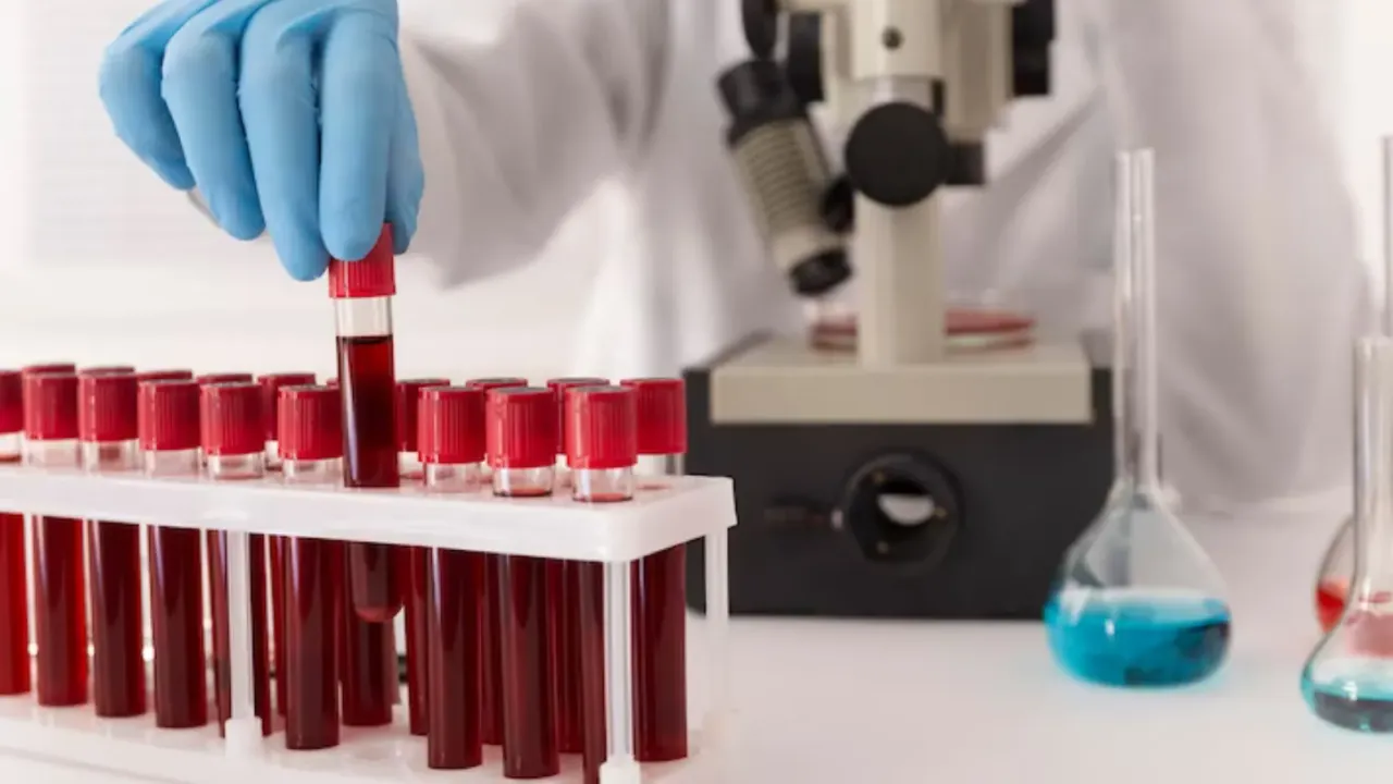 İzmir'de 13 yaşındaki çocuğa HIV bulaştı mı? Kızılay'dan açıklama