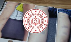 Diyarbakır'da öğrenciye darp iddiasına idari soruşturma