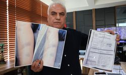 Diyarbakır'da veli ile okul yönetimi karşı karşıya: Çocuğu kim darbetti?