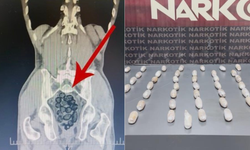 Yabancı uyruklu şahsın midesinden uyuşturucu çıktı