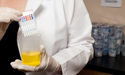 Sektörlerde uyuşturucu testi talebinde dikkat çeken artış