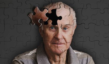 Bilim dünyası heyecanlı: Ucuz ve etkili bir Alzheimer ilacı mı geliyor?