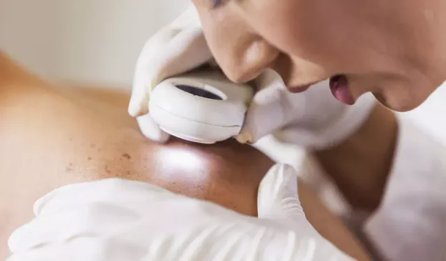 Güzelleşmek uğruna kanser riski! Dermatologlardan solaryum uyarısı