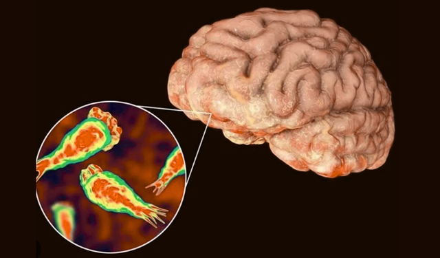 69 vaka, 19 ölü: Hindistan’da beyin yiyen amip paniği