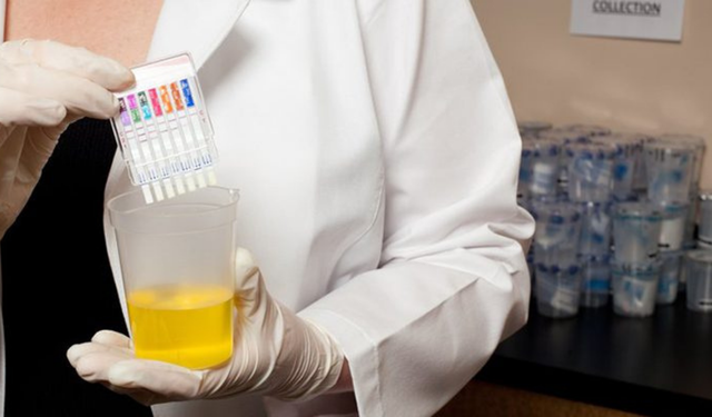 Sektörlerde uyuşturucu testi talebinde dikkat çeken artış