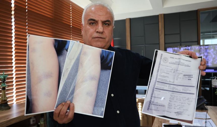 Diyarbakır'da veli ile okul yönetimi karşı karşıya: Çocuğu kim darbetti?