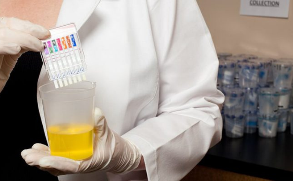 Sektörlerde uyuşturucu testi talebinde dikkat çeken artış